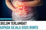 Gejala Penyakit Usus Buntu