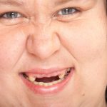 Anodontia, Kelainan Langka Seseorang Tidak Memiliki Gigi